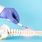 Doctor's hand with a scalpel near the mock up of the human spine on a blue background.