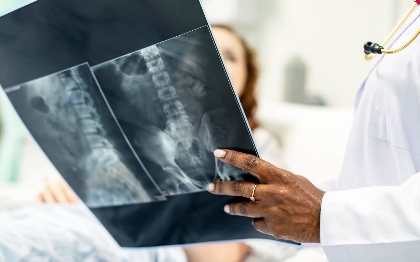 Understanding the Duration and Recovery of Minimally Invasive Spine Surgery